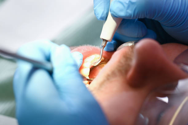 Best Urgent Care for Lost Fillings or Crowns in Ferry Pass, FL