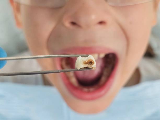 Best Weekend Emergency Dentist in Ferry Pass, FL